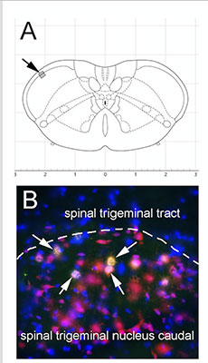 Figure 2ab